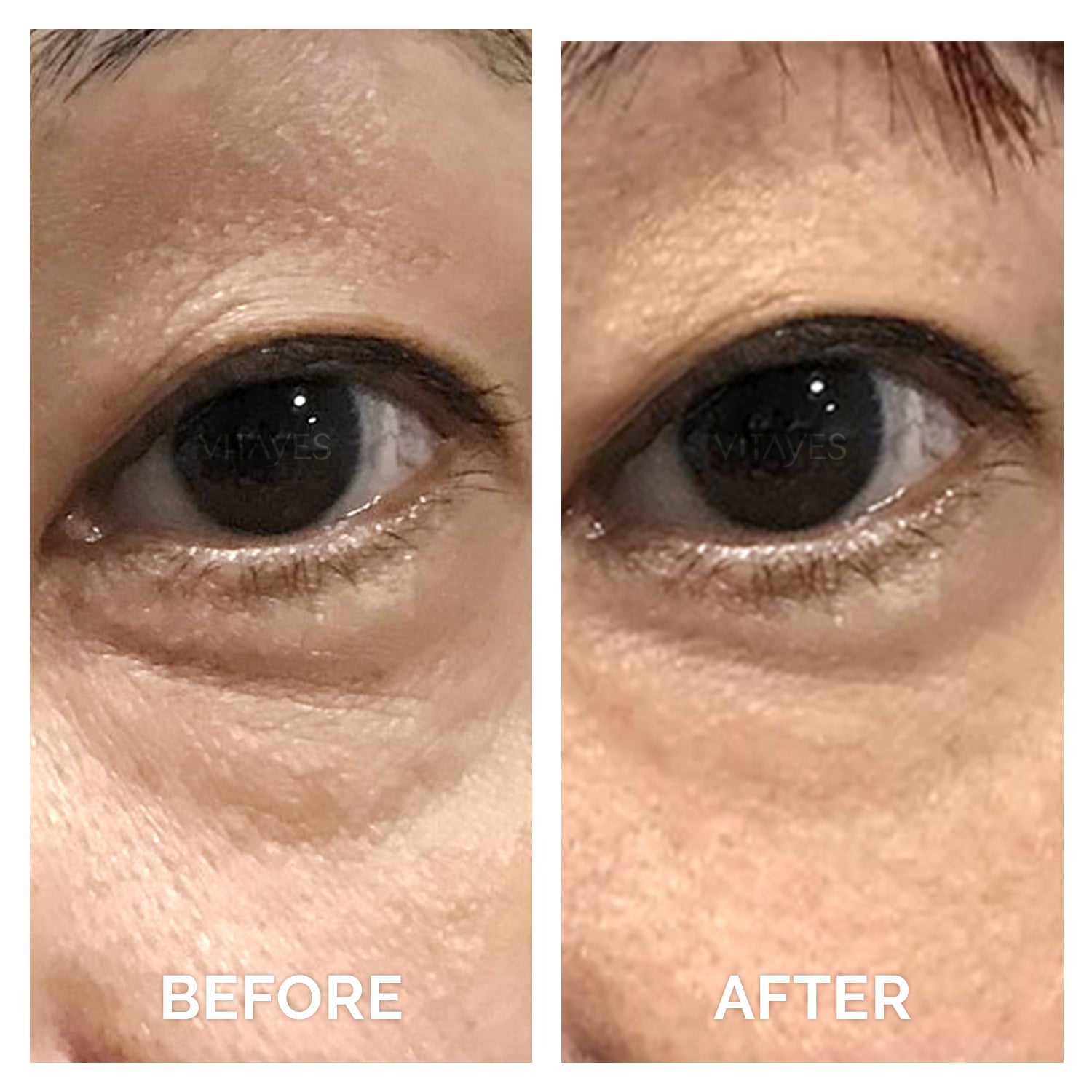 Perfector, eye gel/serum, eye cream with immediate anti-aging effect for light wrinkles. Unique instant brightening effect against dark circles under the eyes.